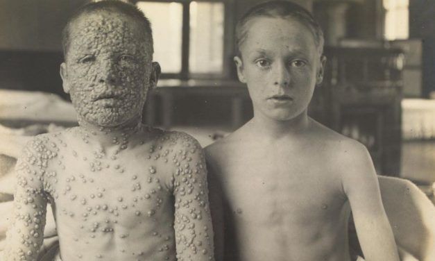 BREVE HISTORIA DE LA VIRUELA Y ORIGEN DE LA OPOSICIÓN A LA VACUNACIÓN EN NUESTROS DÍAS.